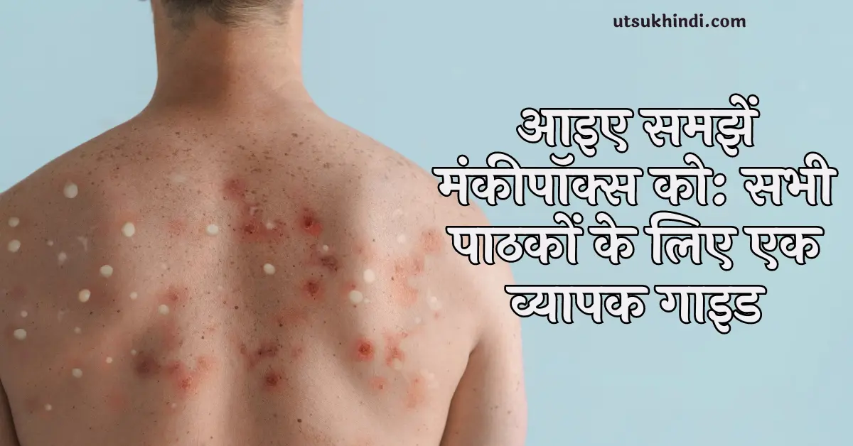 Understanding Monkeypox in hindi