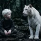 एल्बिनिज्म (Albinism) क्या है, क्यों होता है और इसके बारे में मिथक